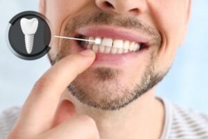 Man pointing to his dental implant