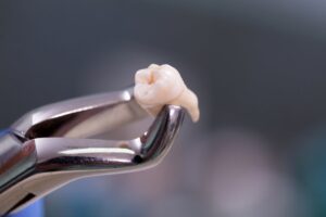 Dentist holding a tooth